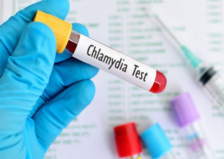 Chlamydia dương tính cảnh báo bệnh xã hội nguy hiểm