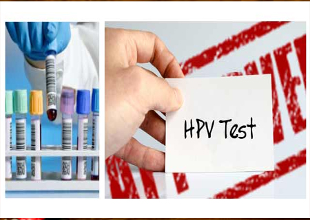 Xét nghiệm HPV ở đâu Nam Định? Gợi ý địa chỉ uy tín