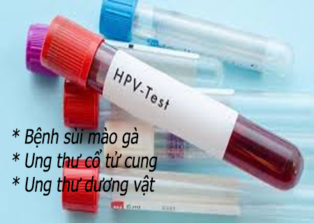 Dương tính HPV người bệnh có thể mắc một số bệnh nguy hiểm